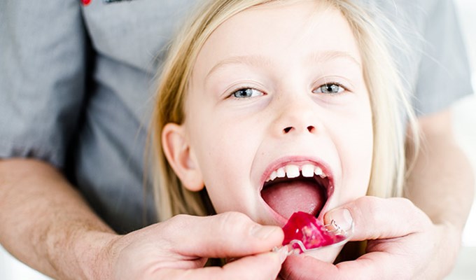 Ljus flicka får hjälp med att sätta in en rosa tandställning i sin mun